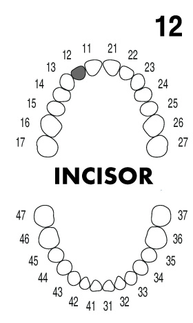INCISOR 1.2