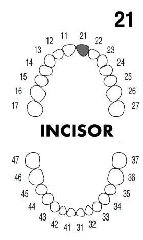 INCISOR 2.1