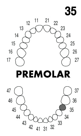 PREMOLAR 3.5