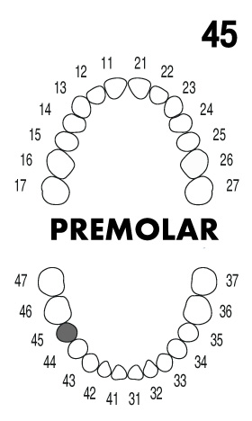 PREMOLAR 4.5